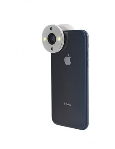 QuikVue - nakładka na smartfon do zdjęć okulistycznych