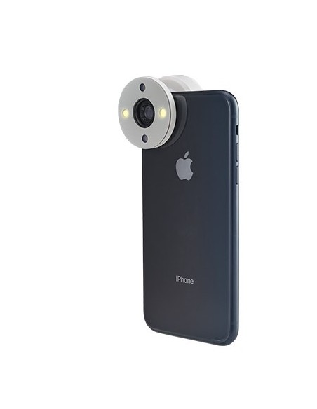 QuikVue - nakładka na smartfon do zdjęć okulistycznych