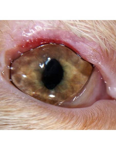 QuikVue - nakładka na smartfon do zdjęć okulistycznych