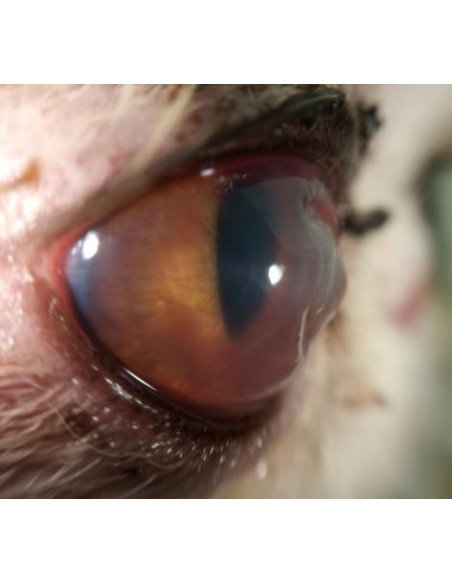 QuikVue - nakładka na smartfon do zdjęć okulistycznych