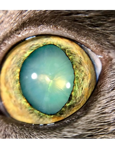 QuikVue - nakładka na smartfon do zdjęć okulistycznych