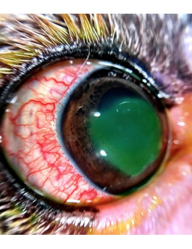 QuikVue - nakładka na smartfon do zdjęć okulistycznych