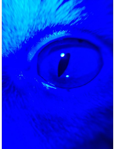 QuikVue - nakładka na smartfon do zdjęć okulistycznych