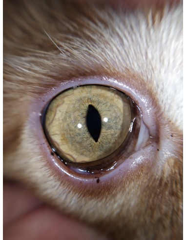 QuikVue - nakładka na smartfon do zdjęć okulistycznych