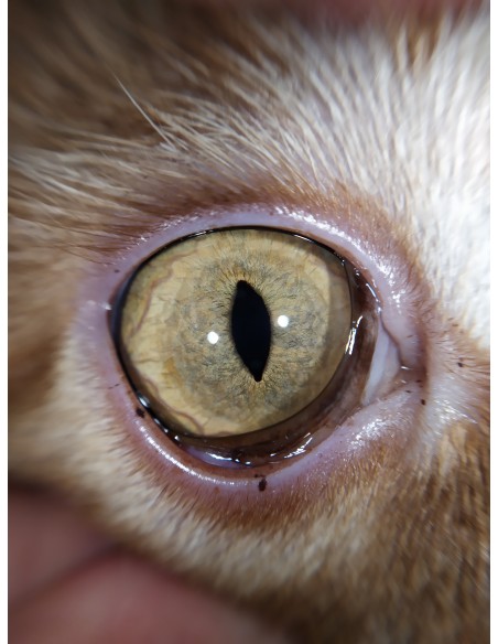 QuikVue - nakładka na smartfon do zdjęć okulistycznych