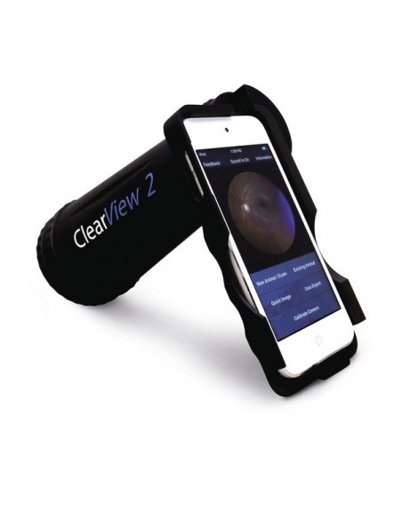ClearView 2 Funduskamera
